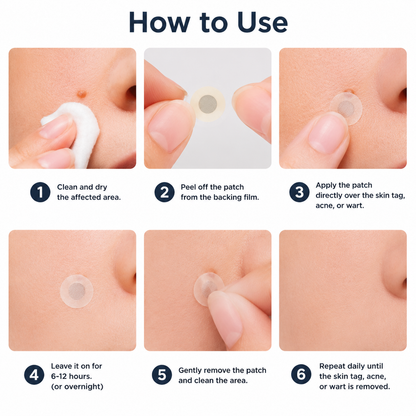 Alisanda®2-in-1 Microneedle & Hydrocolloid Patch🍀| Removes Raised Moles, Acne, Flat Warts & Skin Tags
