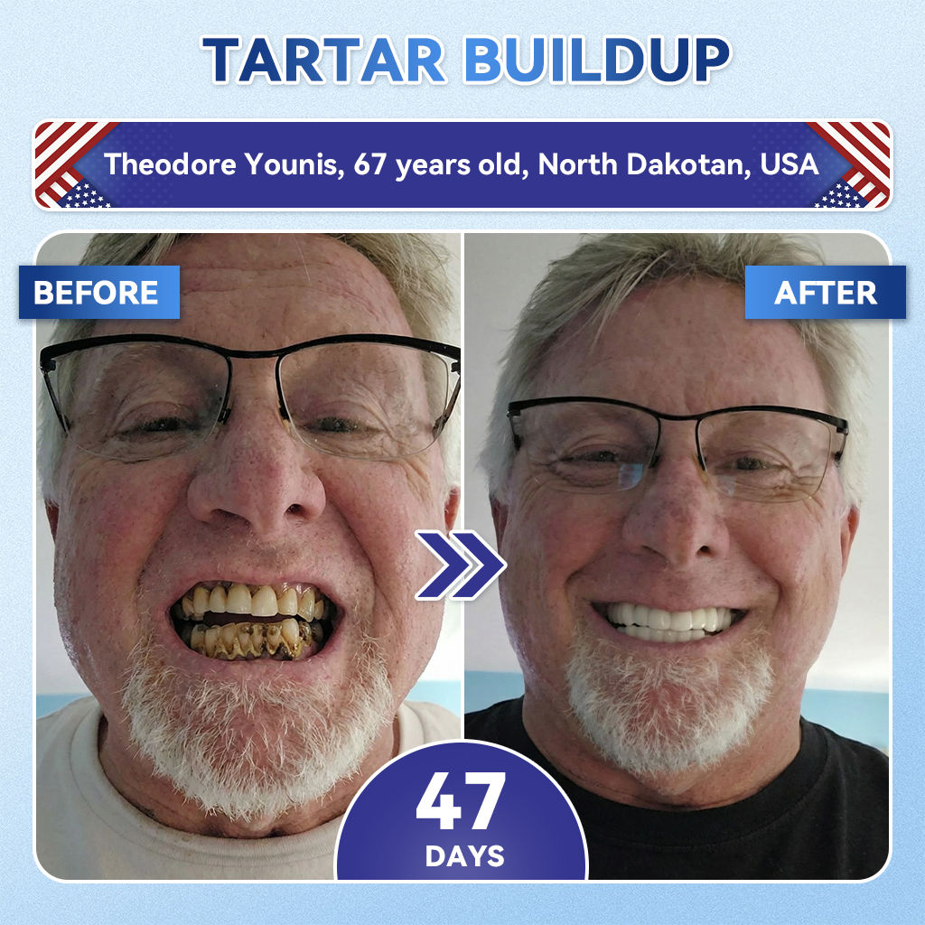 Alisanda® 🦷 Tideglusib Fast‑Dissolving Tooth & Gum Repair Oral Strips ✨