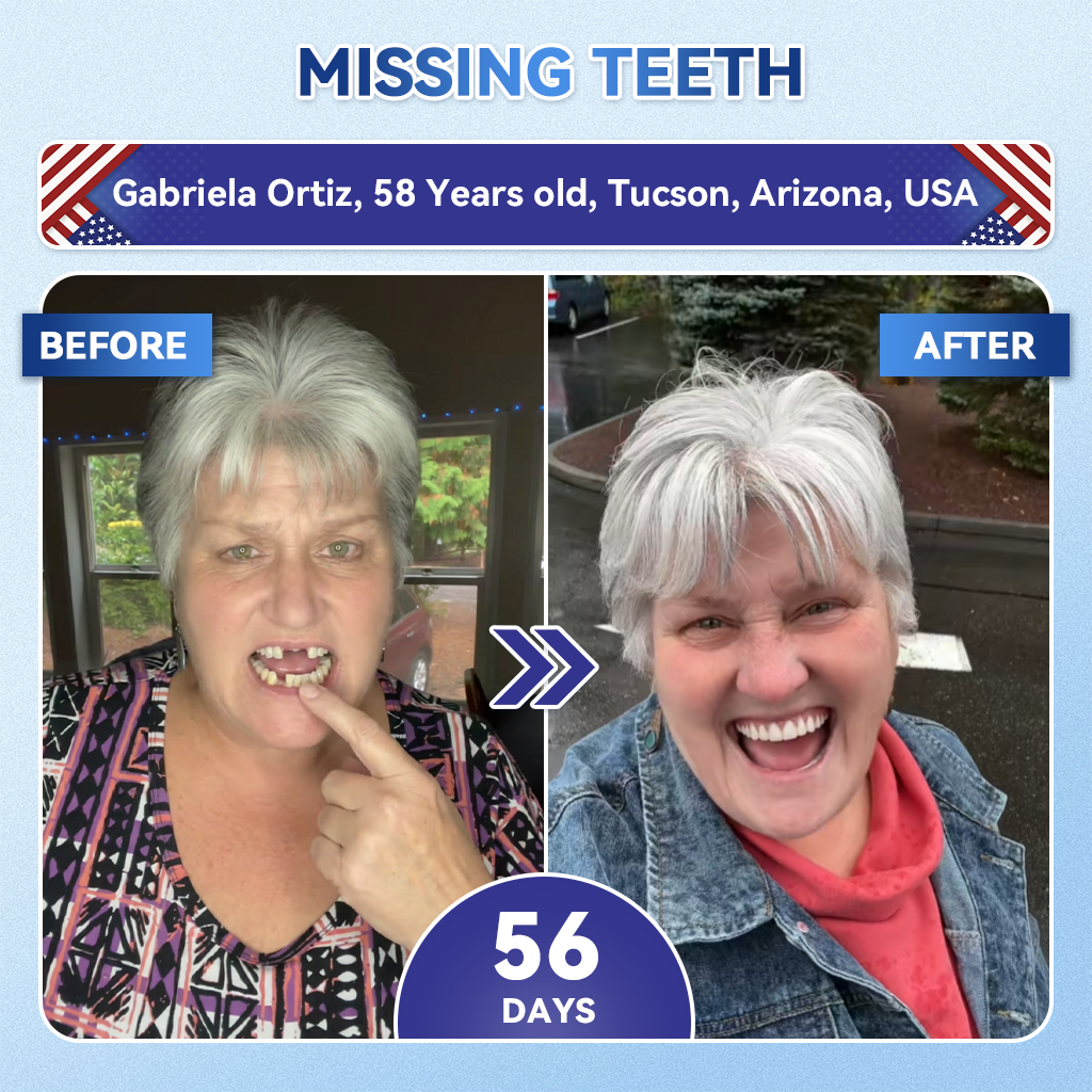 Alisanda® 🦷 Tideglusib Fast‑Dissolving Tooth & Gum Repair Oral Strips ✨