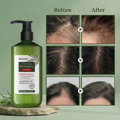 🔥LAST DAY 60% OFF🔥Alisanda® Rosemary Volumizing Shampoo