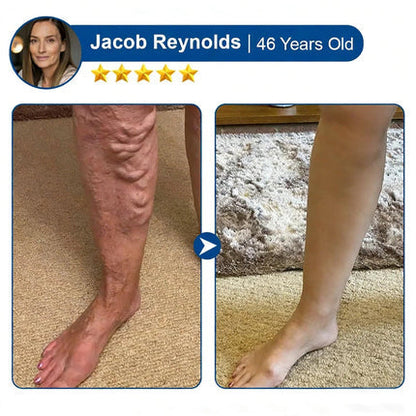 🇺🇸👨‍⚕️✅Alisanda® VeinTarget Microneedle Patch