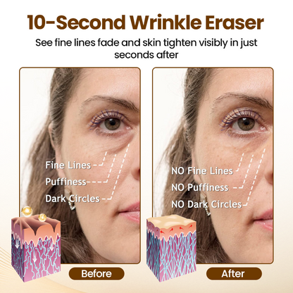 LOVILDS® 10s Wrinkle Serum
