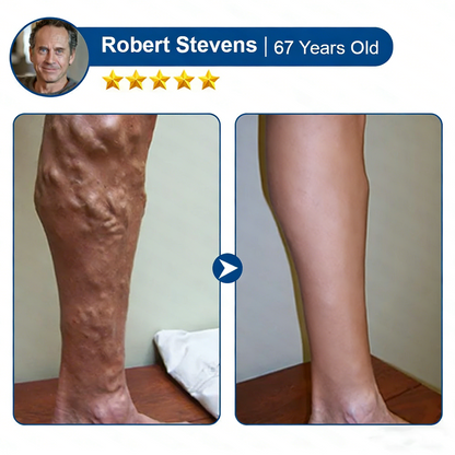 🇺🇸👨‍⚕️✅Alisanda® VeinTarget Microneedle Patch