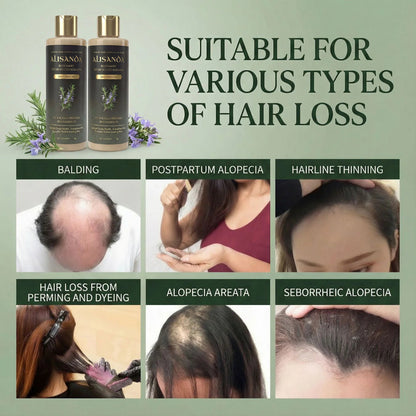 🔥LAST DAY 70% OFF🔥Alisanda® Rosemary Shampoo – Now Upgraded for Superior Hair Growth!