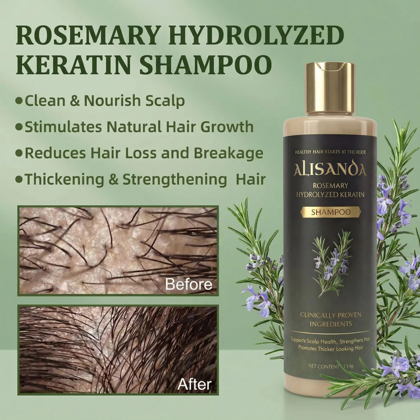 🔥LAST DAY 70% OFF🔥Alisanda® Rosemary Shampoo – Now Upgraded for Superior Hair Growth!