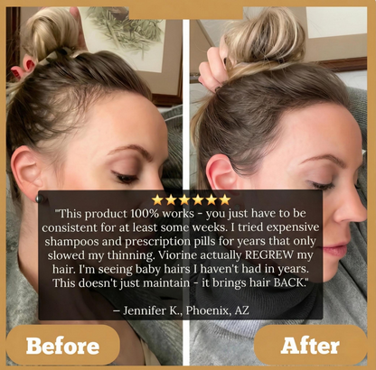 Viralona Batana Hair Oil