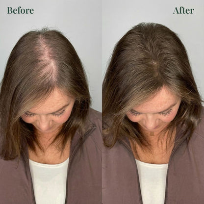 🔥LAST DAY 70% OFF🔥Alisanda® Rosemary Shampoo – Now Upgraded for Superior Hair Growth!