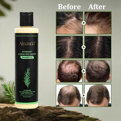 🔥LAST DAY 50% OFF🔥Alisanda® Organic Rosemary Hair Growth Shampoo