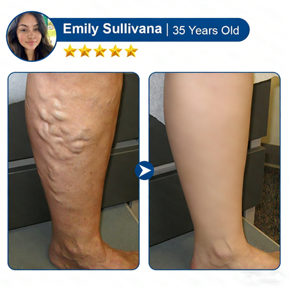 🇺🇸👨‍⚕️✅Alisanda® VeinTarget Microneedle Patch