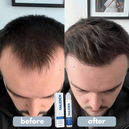 TAILEDEN Pro-Growth Roll-On Hair Growth Serum | Fuller Hair & Firmer Scalp