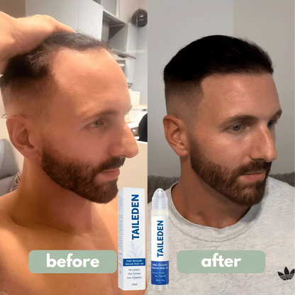 TAILEDEN Pro-Growth Roll-On Hair Growth Serum | Fuller Hair & Firmer Scalp